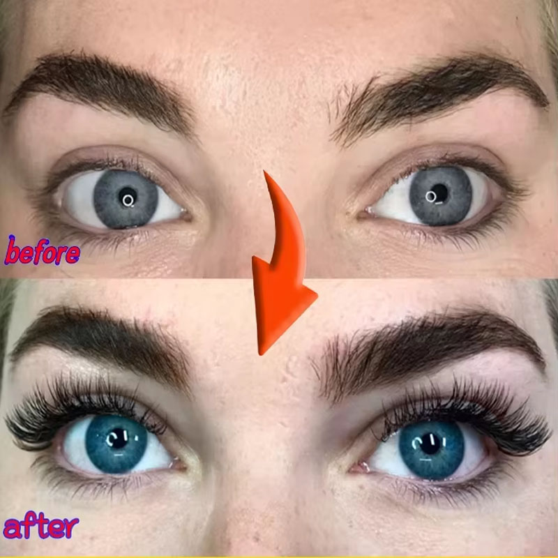 Serum pertumbuhan bulu mata ce - Lash Serum Growth ulasan dan harga